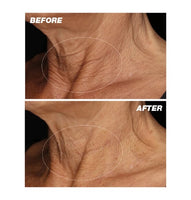 Neck Fit Contour Serum